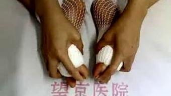 脚手术视频,专业视频带你了解手术细节